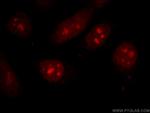 CDCA7 Antibody in Immunocytochemistry (ICC/IF)
