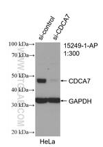 CDCA7 Antibody in Western Blot (WB)