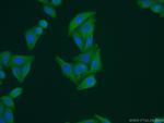 GEMIN8 Antibody in Immunocytochemistry (ICC/IF)
