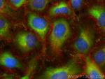 TRIM62 Antibody in Immunocytochemistry (ICC/IF)