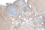 TRIM62 Antibody in Immunohistochemistry (Paraffin) (IHC (P))