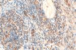 TRIM62 Antibody in Immunohistochemistry (Paraffin) (IHC (P))
