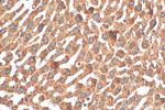 TRIM62 Antibody in Immunohistochemistry (Paraffin) (IHC (P))