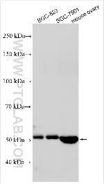TRIM62 Antibody in Western Blot (WB)