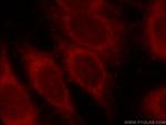 MLYCD Antibody in Immunocytochemistry (ICC/IF)