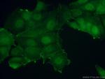S6K2 Antibody in Immunocytochemistry (ICC/IF)