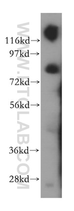 INTS10 Antibody in Western Blot (WB)