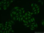 POP4 Antibody in Immunocytochemistry (ICC/IF)