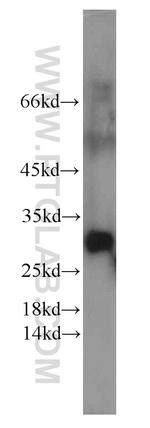 POP4 Antibody in Western Blot (WB)