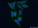 VAPA Antibody in Immunocytochemistry (ICC/IF)
