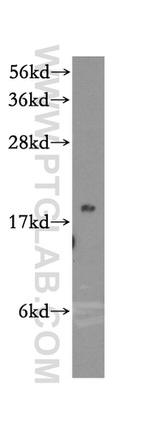 MRPS25 Antibody in Western Blot (WB)