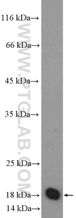 MRPS25 Antibody in Western Blot (WB)