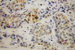 POLE3 Antibody in Immunohistochemistry (Paraffin) (IHC (P))