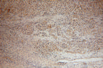 POLE3 Antibody in Immunohistochemistry (Paraffin) (IHC (P))