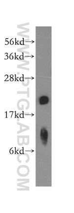 POLE3 Antibody in Western Blot (WB)