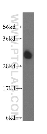 ATP6V1E1 Antibody in Western Blot (WB)