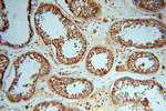 ATP6V1E1 Antibody in Immunohistochemistry (Paraffin) (IHC (P))