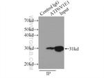 ATP6V1E1 Antibody in Immunoprecipitation (IP)