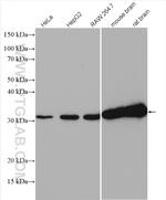 ATP6V1E1 Antibody in Western Blot (WB)