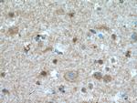 HJURP Antibody in Immunohistochemistry (Paraffin) (IHC (P))