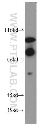 HJURP Antibody in Western Blot (WB)