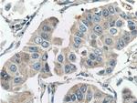 GALK1 Antibody in Immunohistochemistry (Paraffin) (IHC (P))