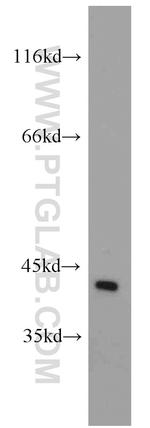 GALK1 Antibody in Western Blot (WB)
