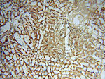 URM1 Antibody in Immunohistochemistry (Paraffin) (IHC (P))