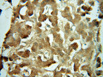 URM1 Antibody in Immunohistochemistry (Paraffin) (IHC (P))