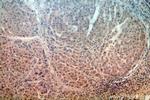 URM1 Antibody in Immunohistochemistry (Paraffin) (IHC (P))