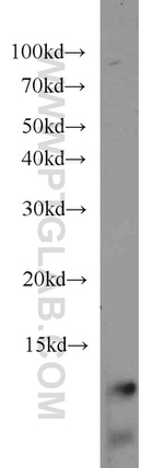 URM1 Antibody in Western Blot (WB)