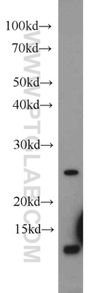URM1 Antibody in Western Blot (WB)