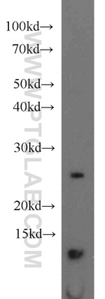 URM1 Antibody in Western Blot (WB)