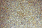 PTPN7 Antibody in Immunohistochemistry (Paraffin) (IHC (P))
