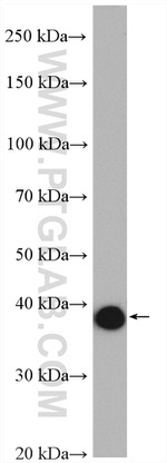 PTPN7 Antibody in Western Blot (WB)