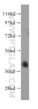 PTPN7 Antibody in Western Blot (WB)