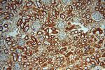 HSPB8 Antibody in Immunohistochemistry (Paraffin) (IHC (P))