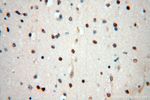 HSPB8 Antibody in Immunohistochemistry (Paraffin) (IHC (P))
