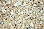 HSPB8 Antibody in Immunohistochemistry (Paraffin) (IHC (P))