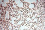 HSPB8 Antibody in Immunohistochemistry (Paraffin) (IHC (P))