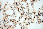HSPB8 Antibody in Immunohistochemistry (Paraffin) (IHC (P))