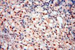 HSPB8 Antibody in Immunohistochemistry (Paraffin) (IHC (P))
