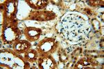 HSPB8 Antibody in Immunohistochemistry (Paraffin) (IHC (P))