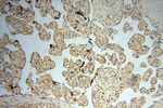 HSPB8 Antibody in Immunohistochemistry (Paraffin) (IHC (P))