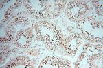 HSPB8 Antibody in Immunohistochemistry (Paraffin) (IHC (P))