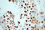 HSPB8 Antibody in Immunohistochemistry (Paraffin) (IHC (P))