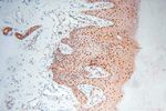 HSPB8 Antibody in Immunohistochemistry (Paraffin) (IHC (P))