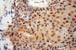 HSPB8 Antibody in Immunohistochemistry (Paraffin) (IHC (P))