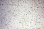 HSPB8 Antibody in Immunohistochemistry (Paraffin) (IHC (P))