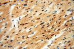 HSPB8 Antibody in Immunohistochemistry (Paraffin) (IHC (P))